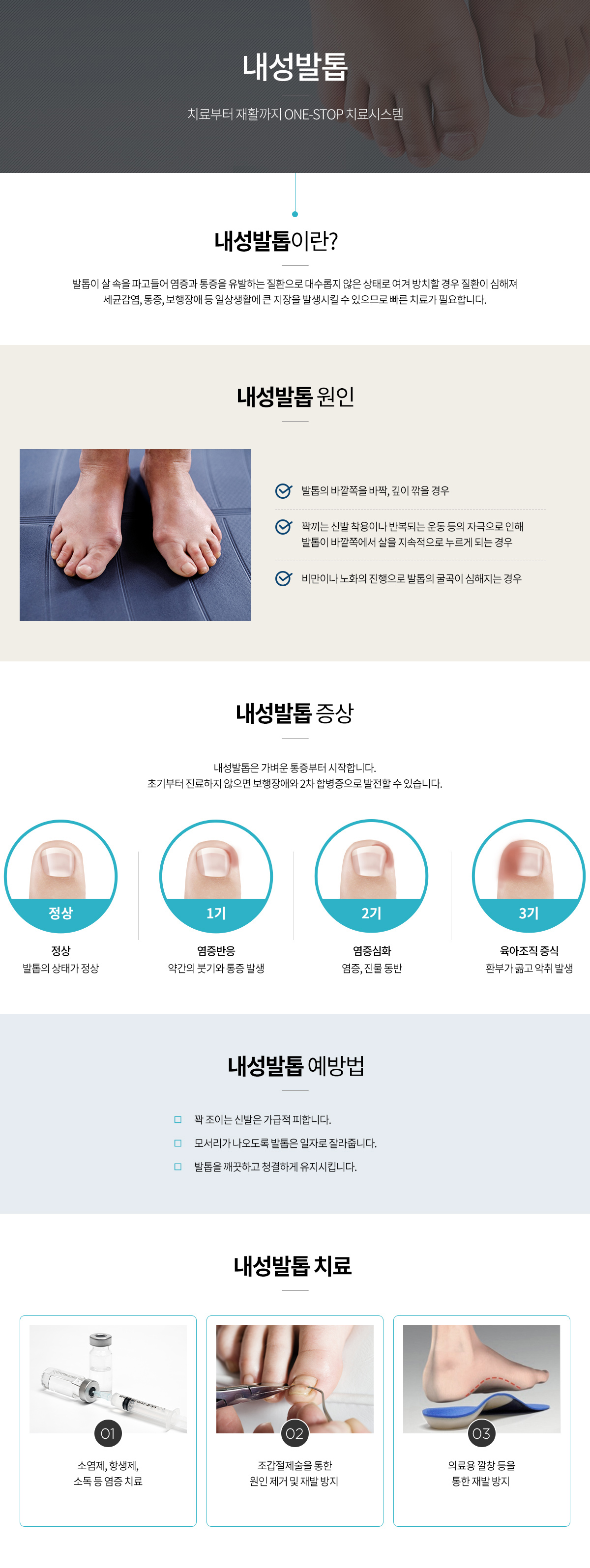 내성발톱 안내 인포그래픽